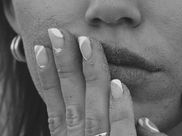 Dry skin 